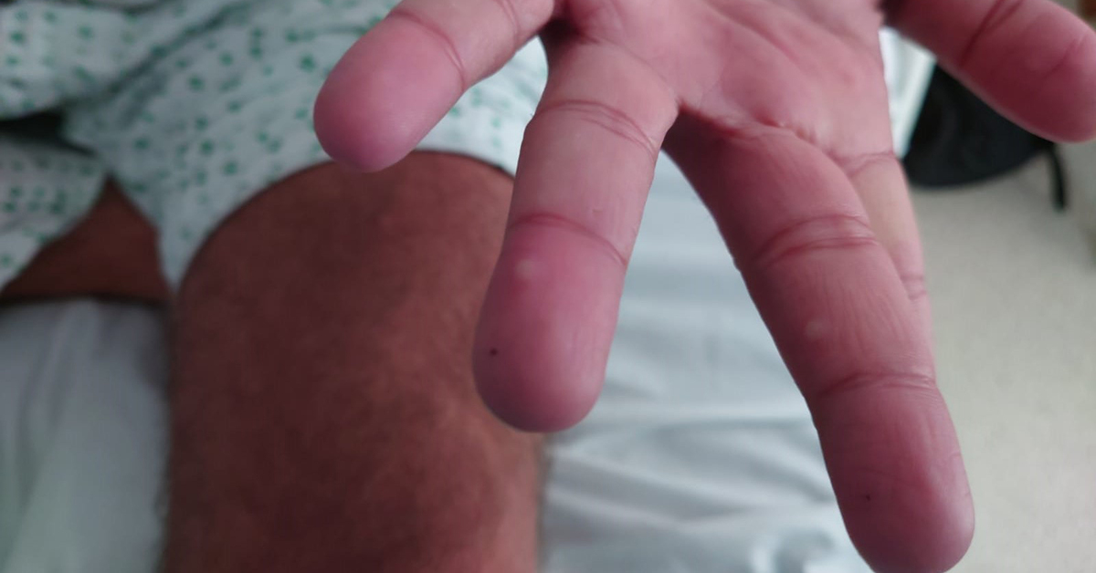 DSÖ’nün farkındalık yüzüydü! “HIV’le hiç sorun yaşamadım ama M çiçeği ızdırabım oldu”
